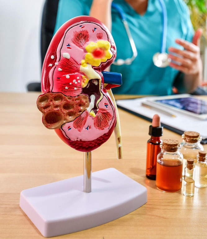 Homeopathy for Kidney Disease